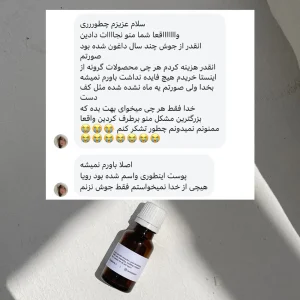 رضایت ضدجوش لونا