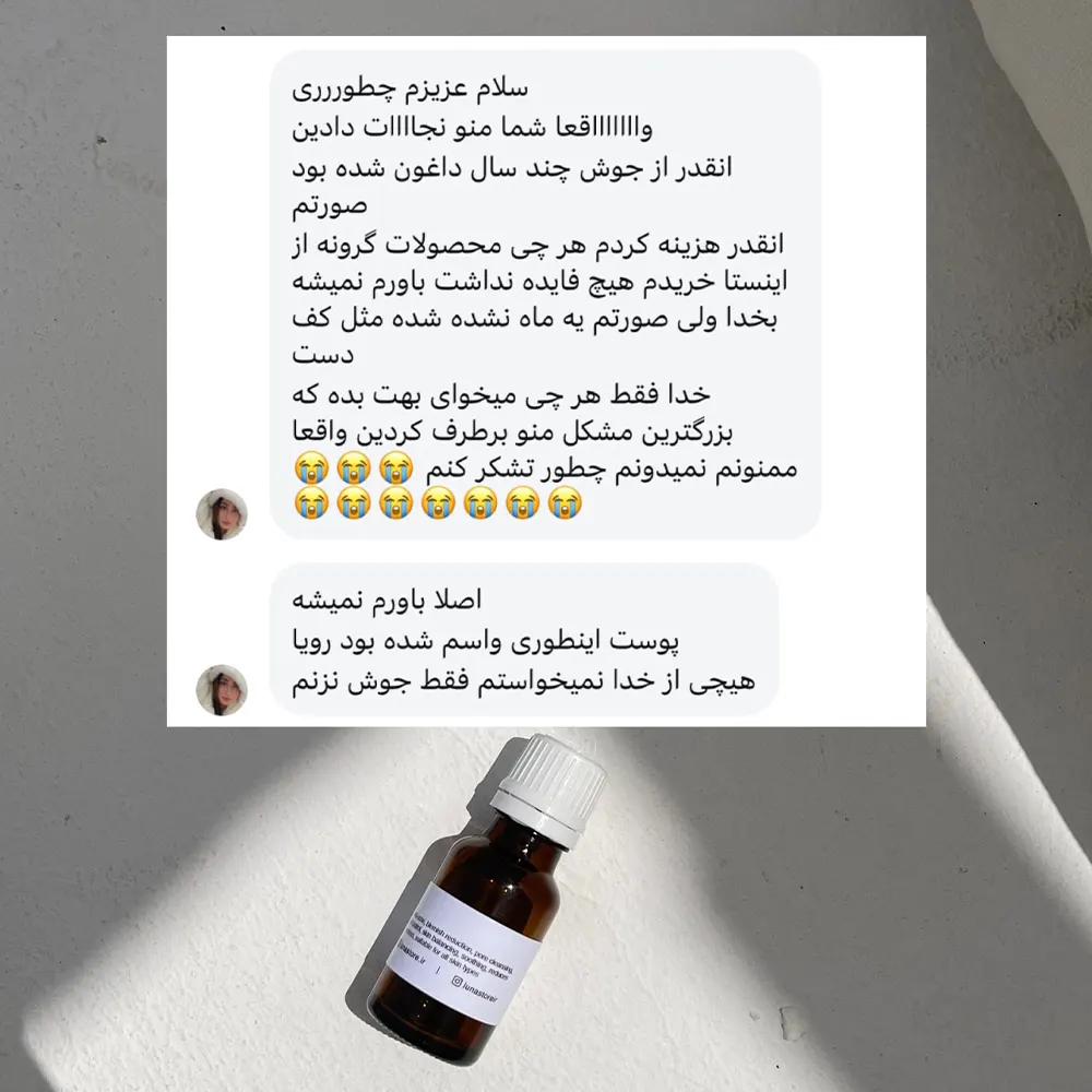 رضایت ضدجوش لونا