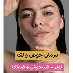 پکیج درمان جوش و لک