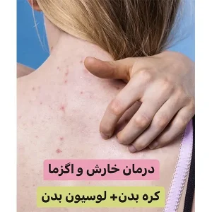 پکیج درمان خارش و اگزما