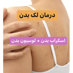 پکیج درمان لک بدن